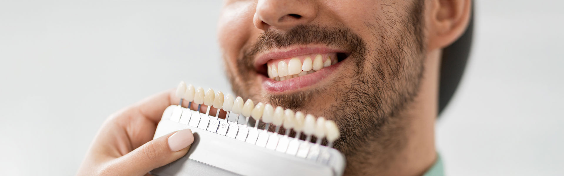 Veneers: The Easy and Quick Approach Towards Tooth Restoration